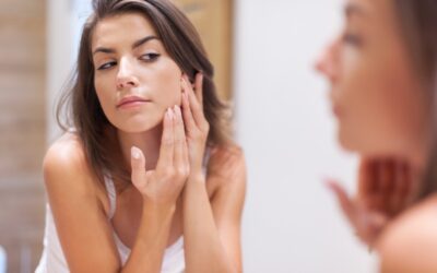 5 Myths About Acne