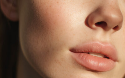 Sculptra vs. HA Fillers