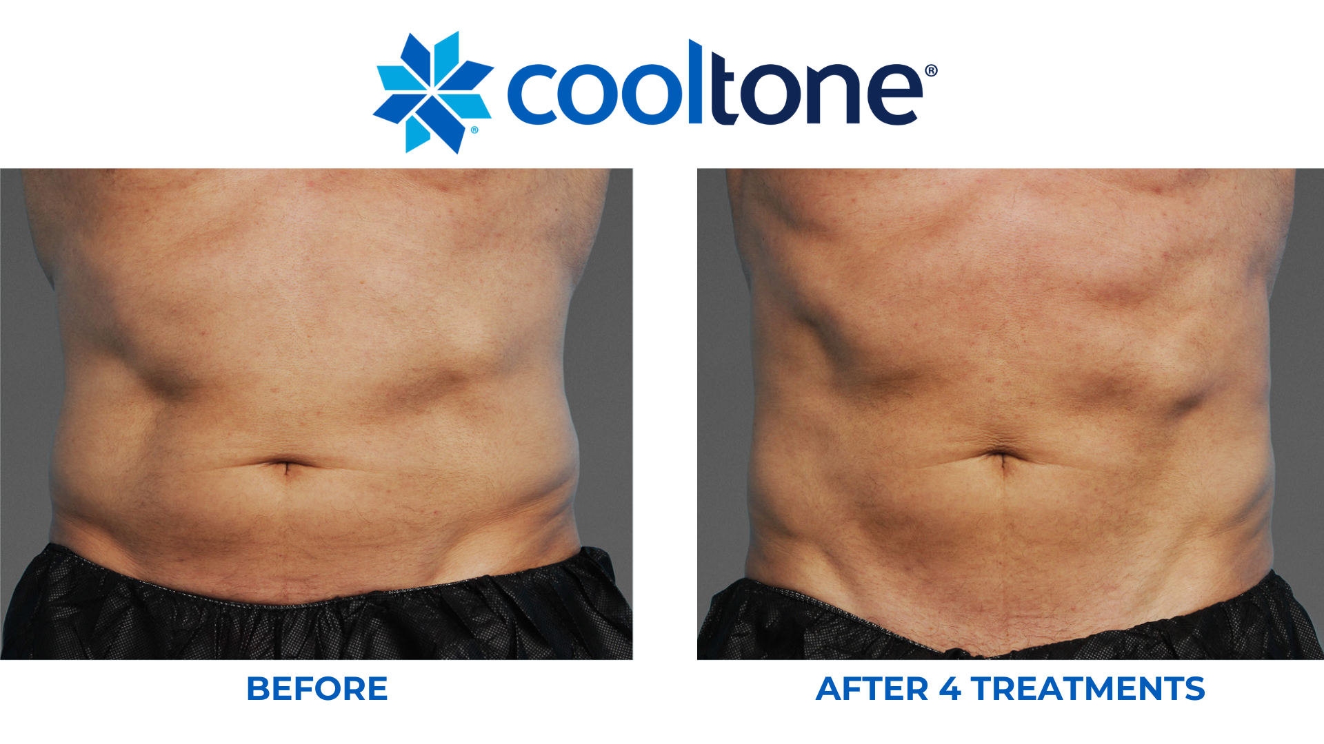 cooltone before and after