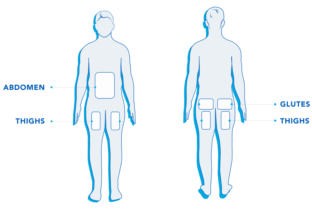 cooltone treatment areas