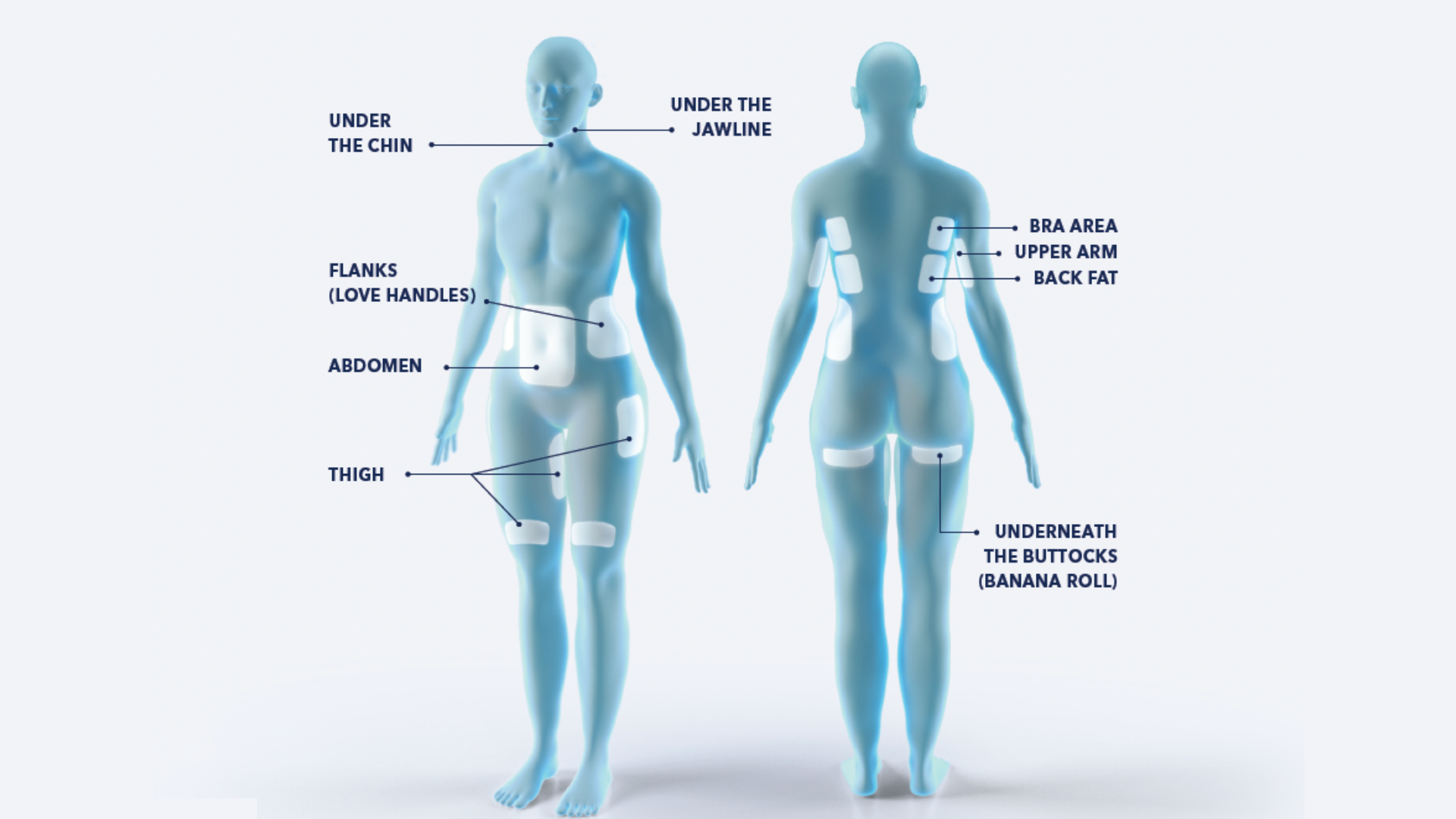 coolsculpting treatment areas