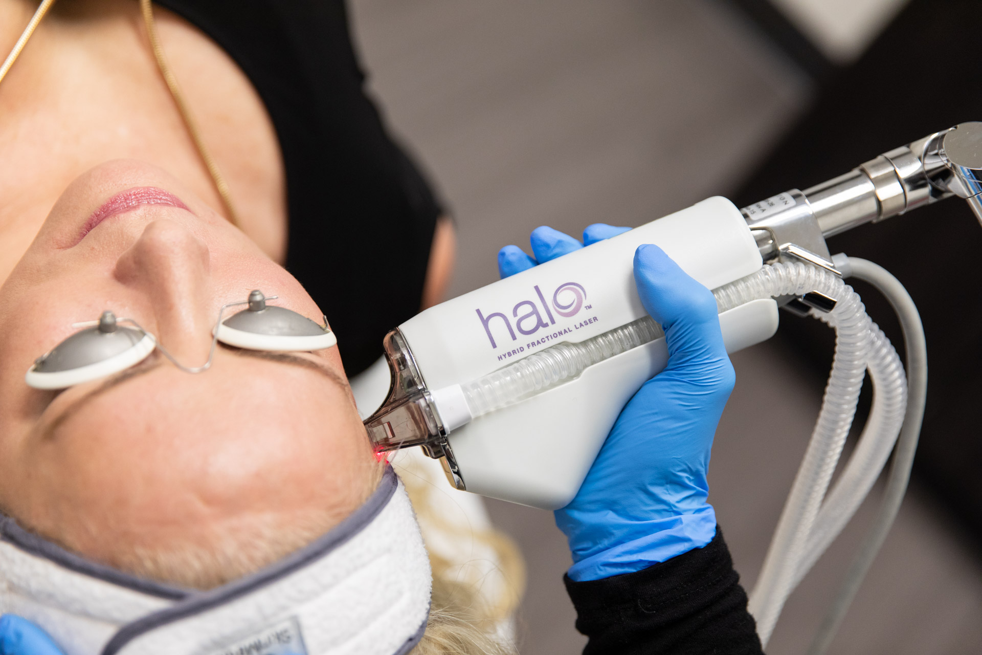 HALO Laser Treatment