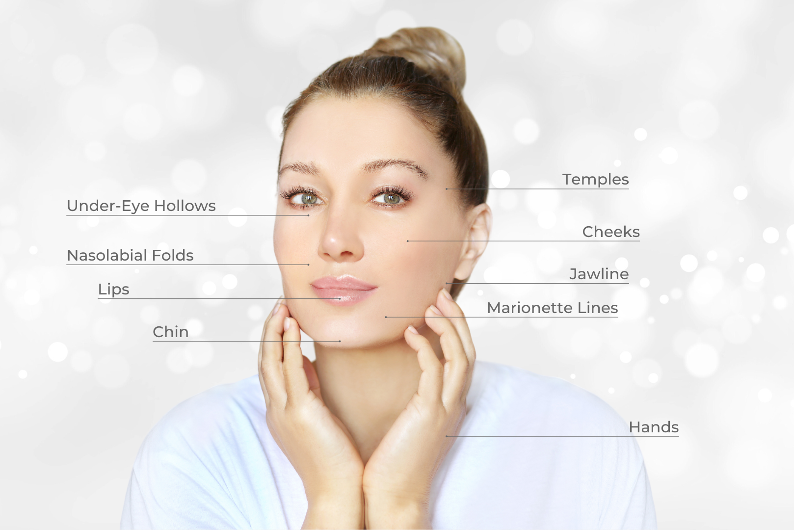 Dermal Filler Treatment Areas